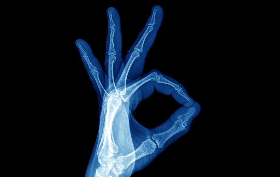 Bulk-billed X-rays