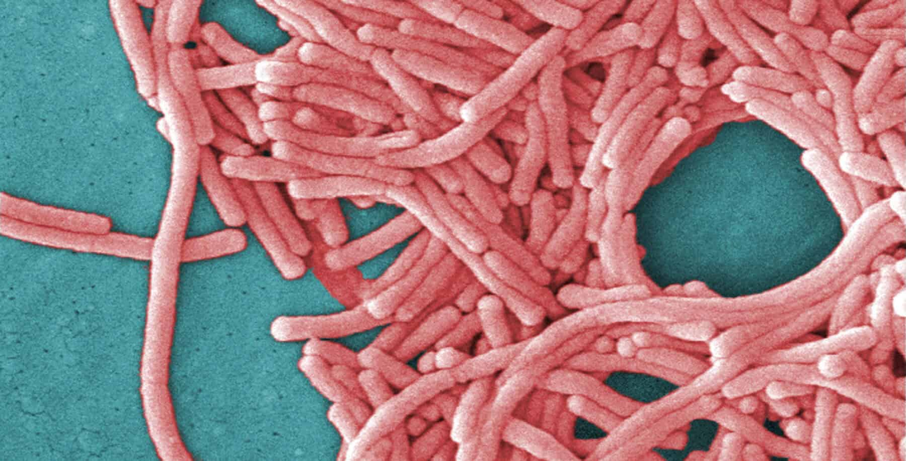 ‘I’m not really concerned’: Toronto experts weigh in on Legionnaires’ disease outbreak